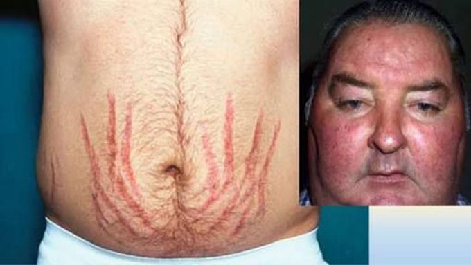 What is your diagnosis??