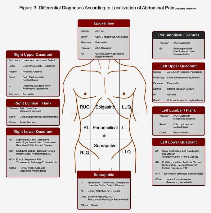 Acute Abdomen DD