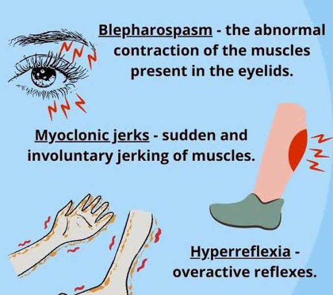 These are the symptoms of Benign fasciculation syndrome