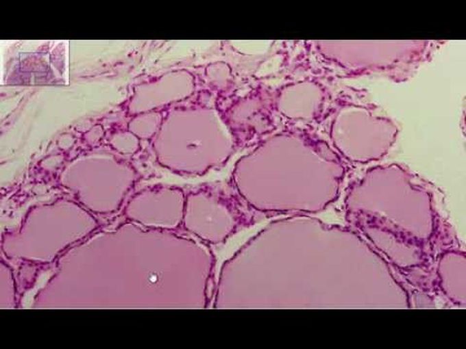 Thyroid Gland Histology: Digital Slide
