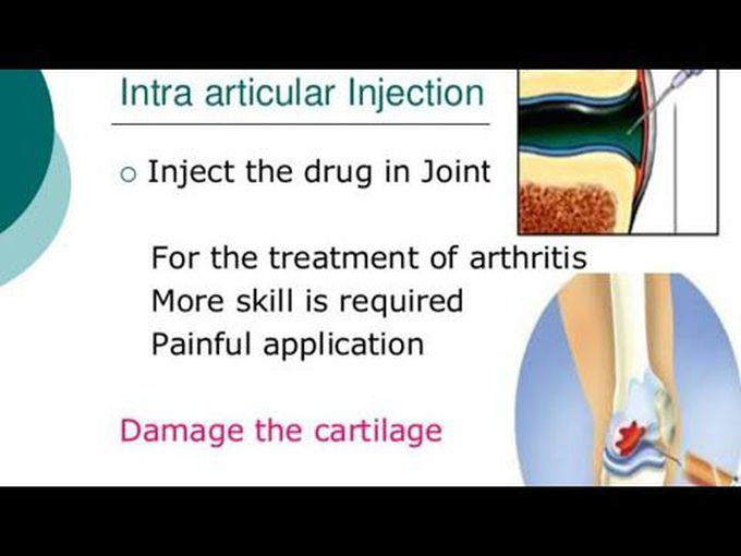 Route of drug administration - Intra Articular and Intrathecal
