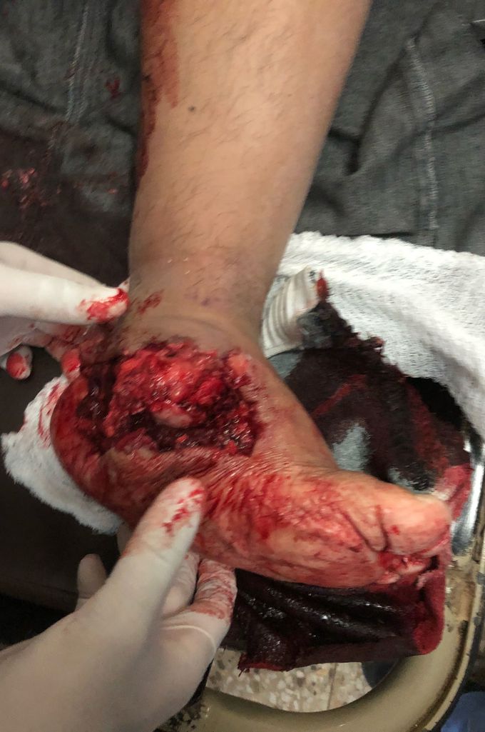 Accidente de tránsito
