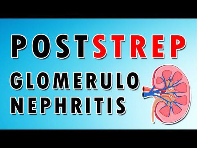 What is Post Streptococcal glomerulonephritis-Explained