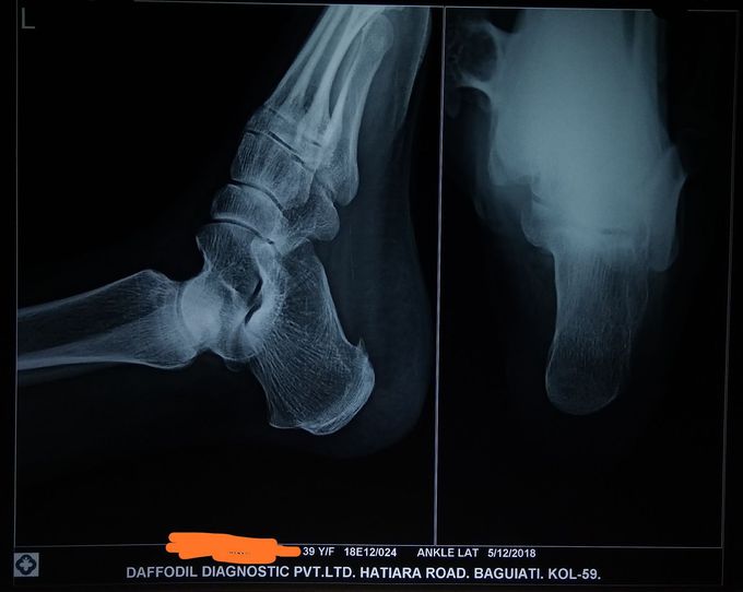 What is the diagnosis???