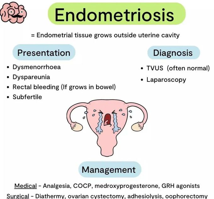 Endometriosis