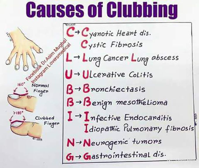 causes_of_clubbing