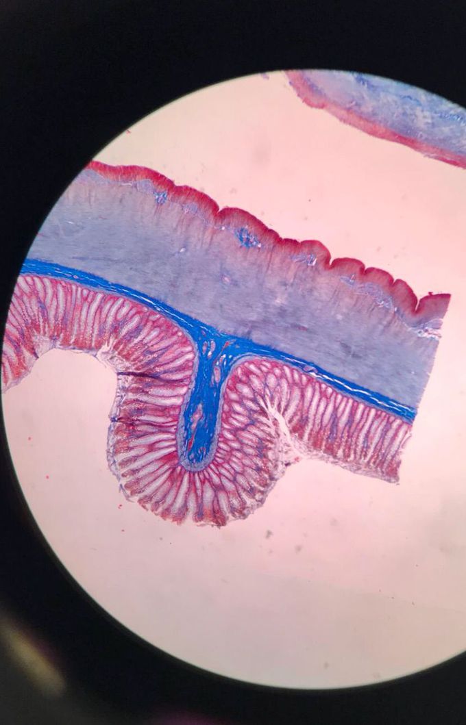 Colon under the microscope