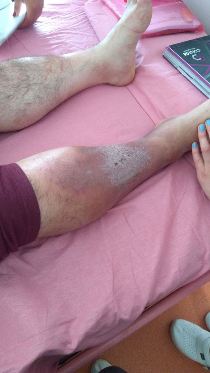 Diagnosis and treatment?
