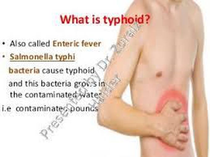 What is typhoid