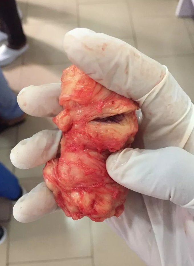 general surgery