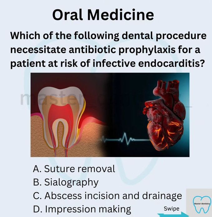 Antibiotic Prophylaxis