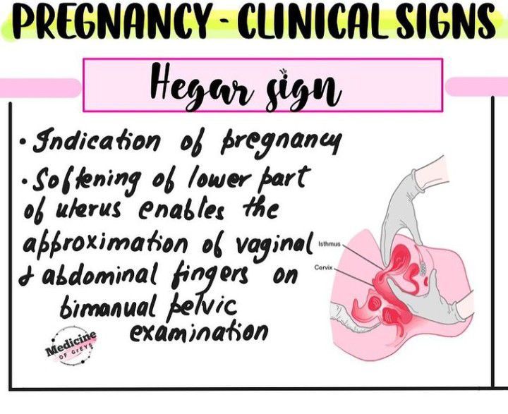 Hegar Sign - MEDizzy