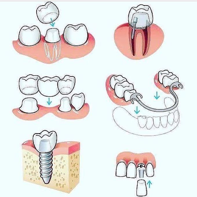 Dental Procedures