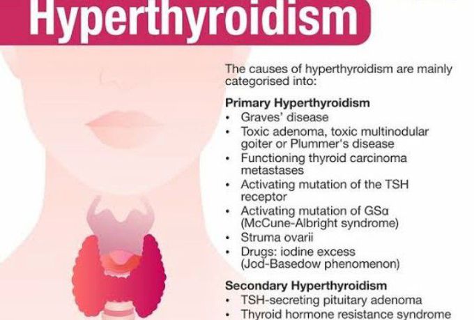 Cause of Thyrotoxicosis