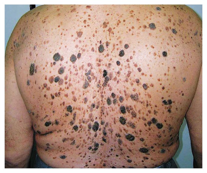 What is your diagnosis???