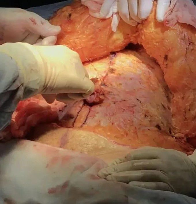 general surgery