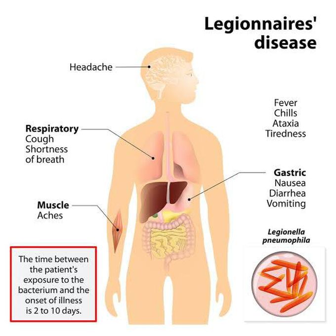 Legionnaire's disease