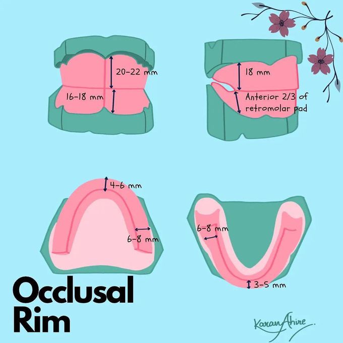 What is Occlusal Rim?