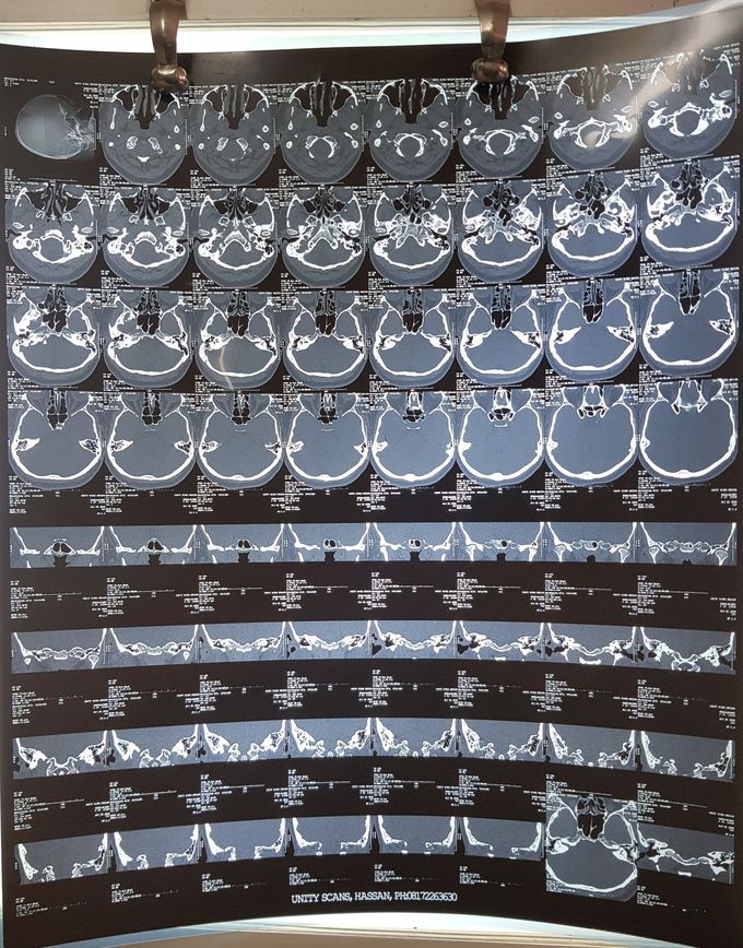 Diagnosis please