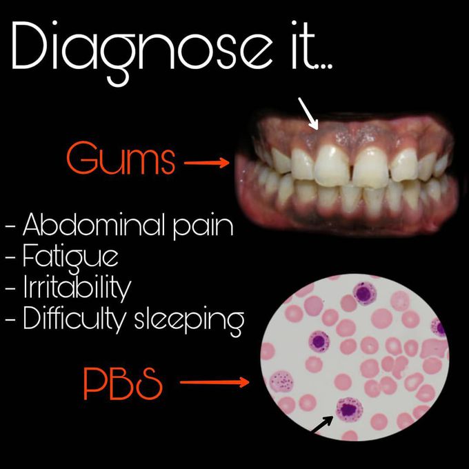 Diagnosis?
