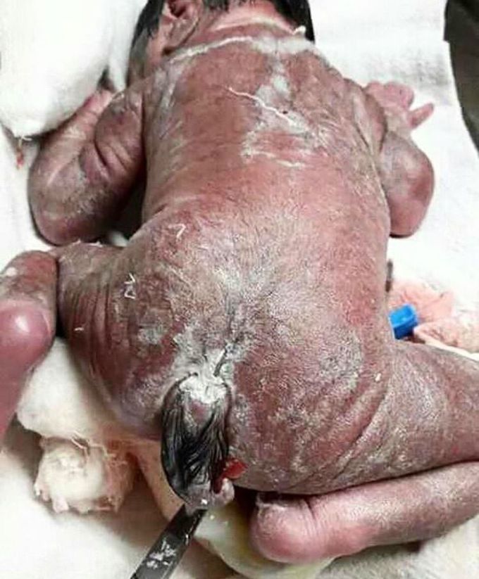 What is the name of this condition ???