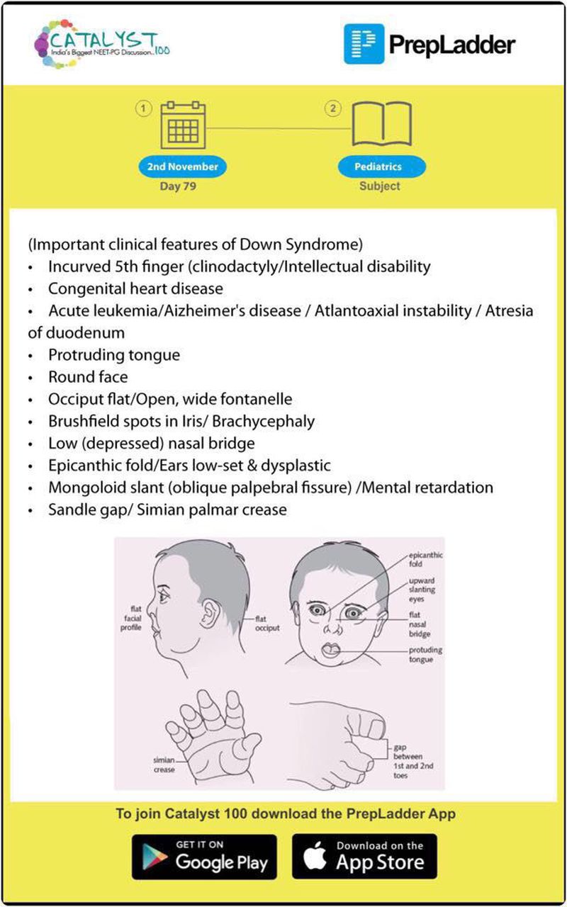 Down Syndrome - MEDizzy