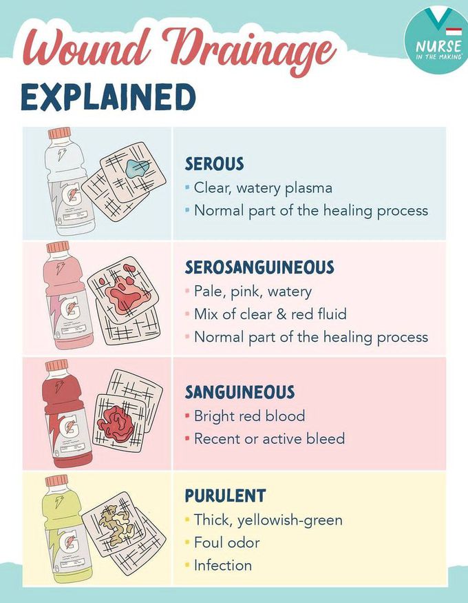 Wound Drainage - MEDizzy