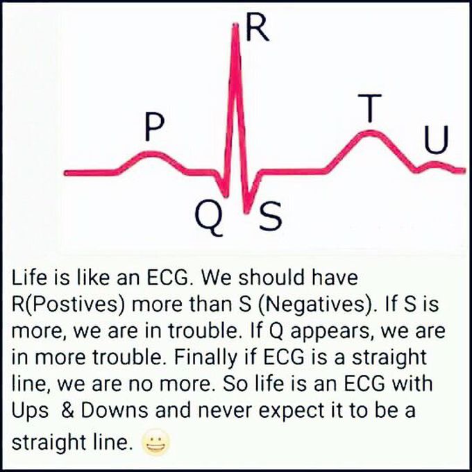 LIFE IS LIKE AN ECG