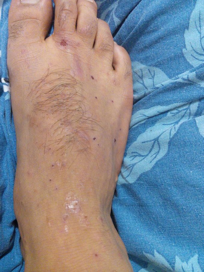 What should be diagnosis !!!