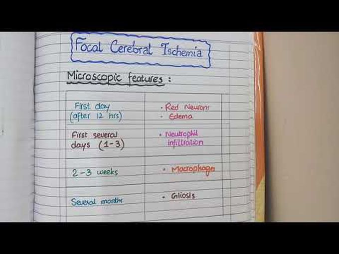 Types of Cerebral Ischemia: Global and Focal