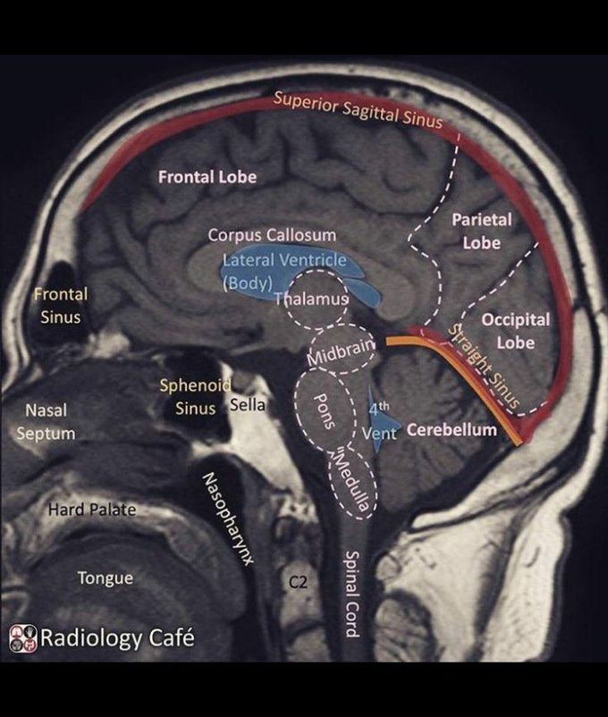 Sagital section