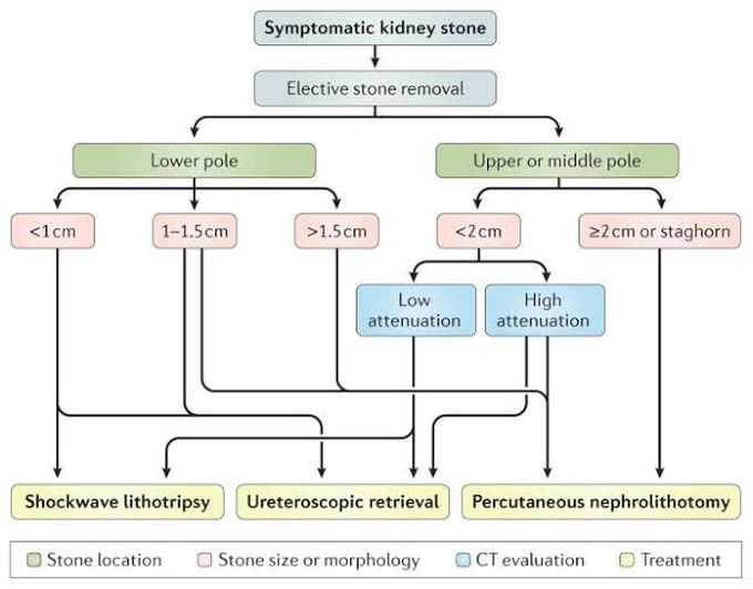 Kidney Stones Management