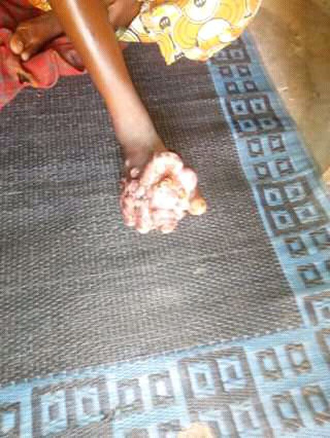 Please diagnosis and treatment