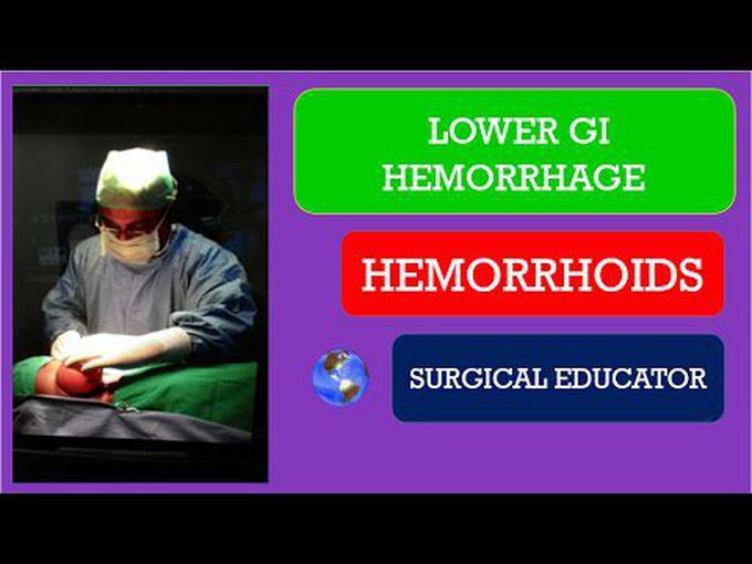 Hemorrhoids: Surgical Overview
