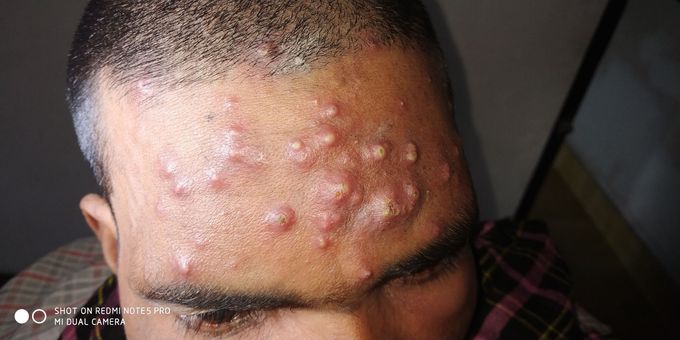 What is your diagnosis
