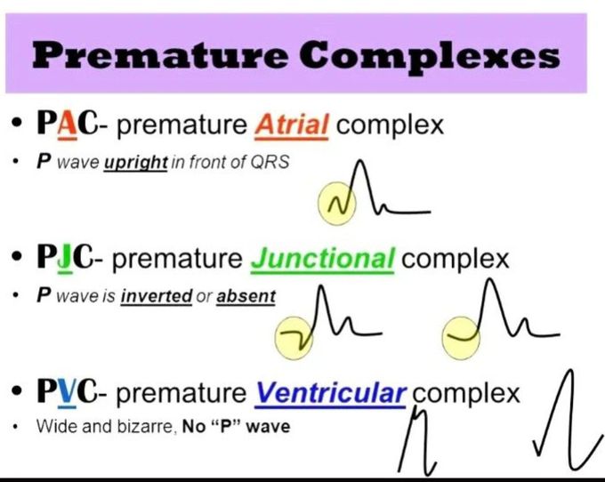 Premature Complexes