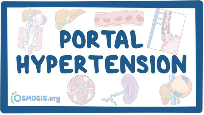 Portal Hypertension