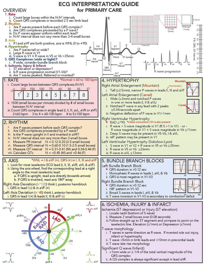 ECG INTERPRETATION