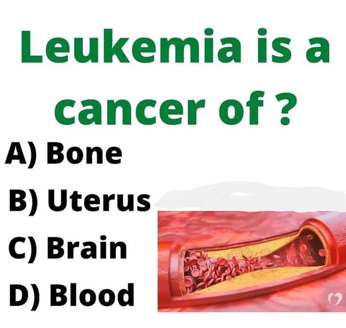 Question of the day