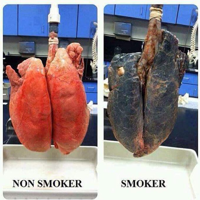 Stop smoking frndz ....