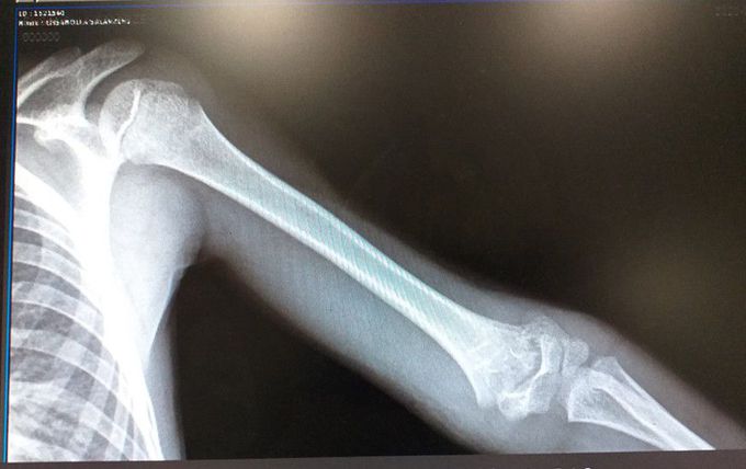 What is your diagnosis?