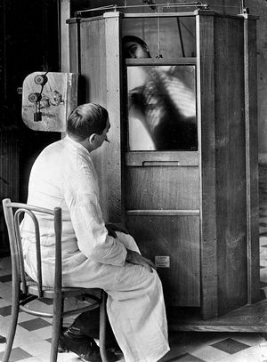 A chest X-ray in 1914