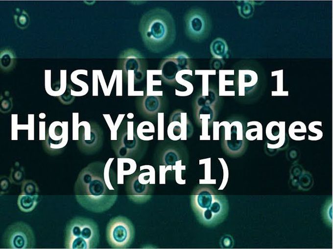 USMLE STEP 1 High Yield Images (Part 1)