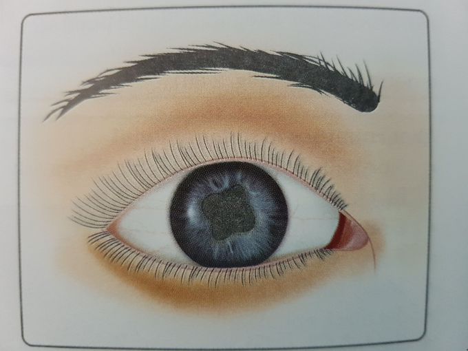 What is the defect here?