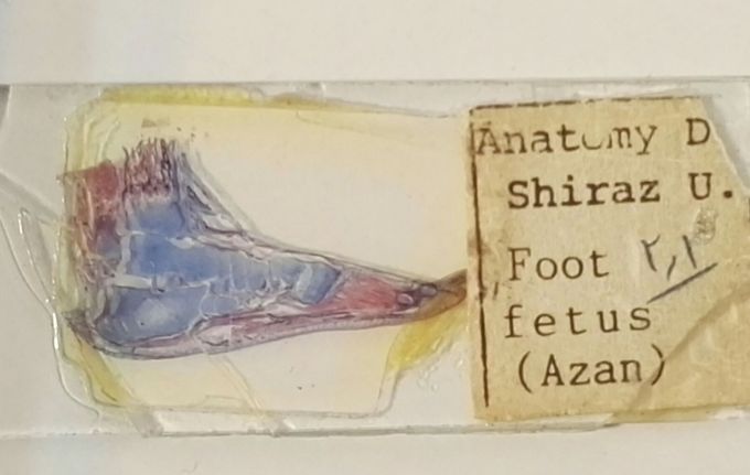 FOOT FETUS❤