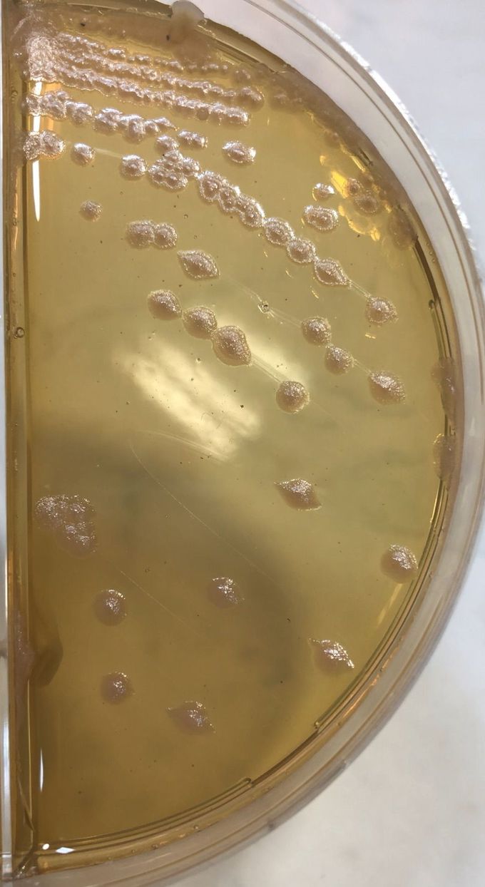 Gram (+) and Gram (-) bacterias do not grow on Saburo agar, because we add Gentamicin to this agar. This Pseudomonas aeruginosa has been grown on Saburo agar, because it is resistant to gentamicin.