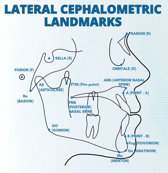 Lateral Ceph Landmarks