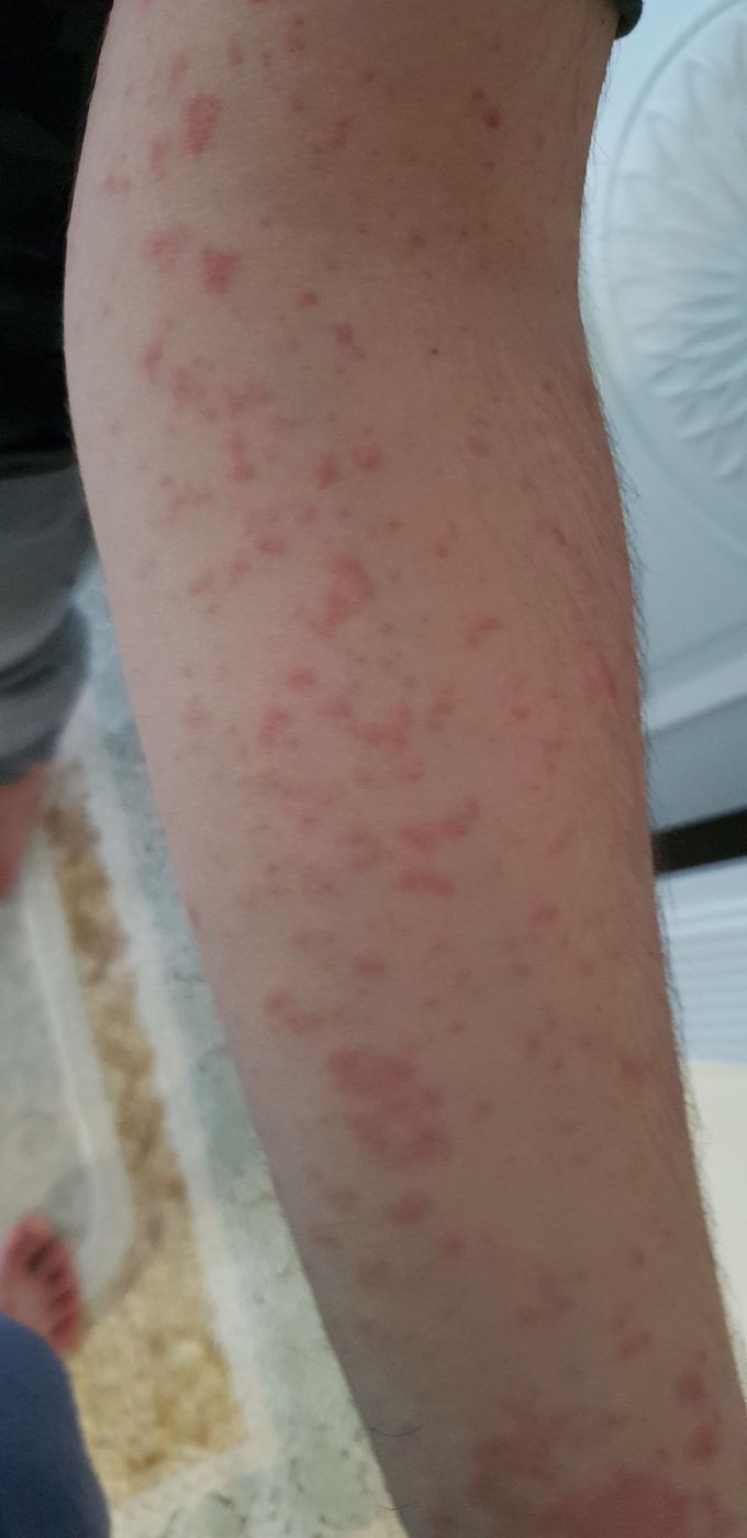 What is this ?