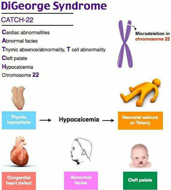 DiGeorge Syndrome