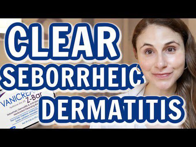 Seborrheic Dermatitis- Treatment